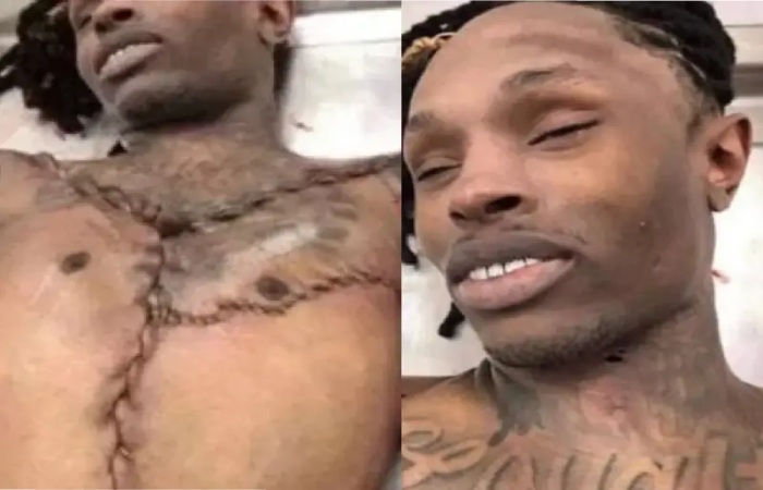 King Von Autopsy Photos Graphic Leaked